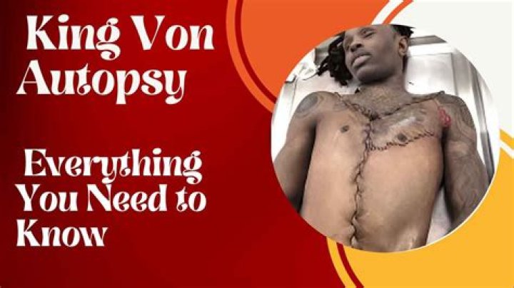	Breaking: Viral Video Reveals Full Autopsy Results of Alexis Murphy	
