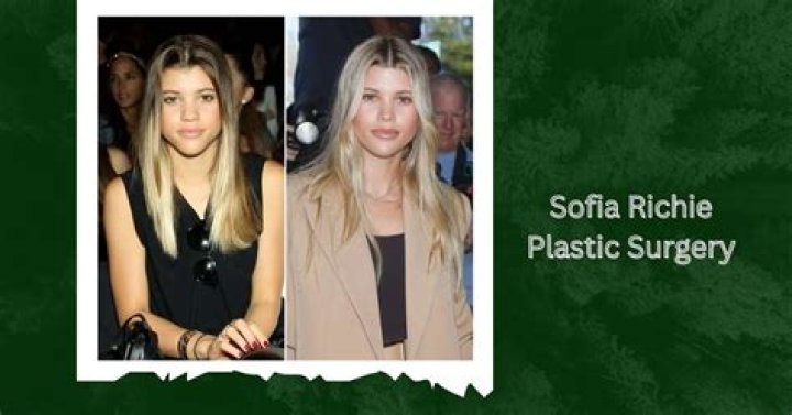 Sofia Richie Before And After: Did She Get Surgery?