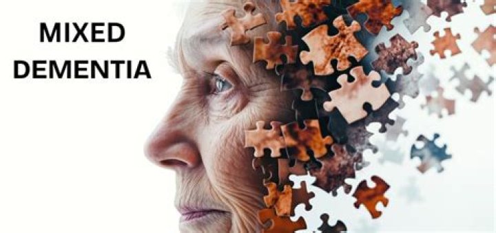 Understanding my emotions after dad's mixed dementia diagnosis: Lucy's story